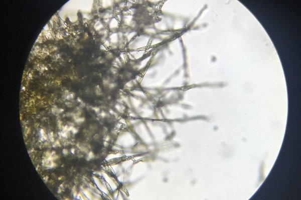 Schimmelpilz-Hyphen unter dem Mikroskop