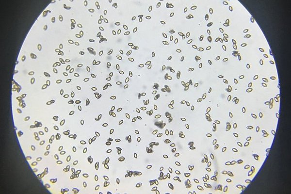 Pilzsporen im Mikroskop