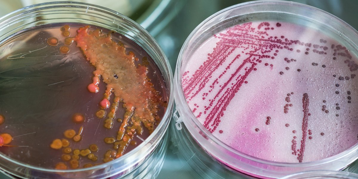 Agarplatten mit Bakterien