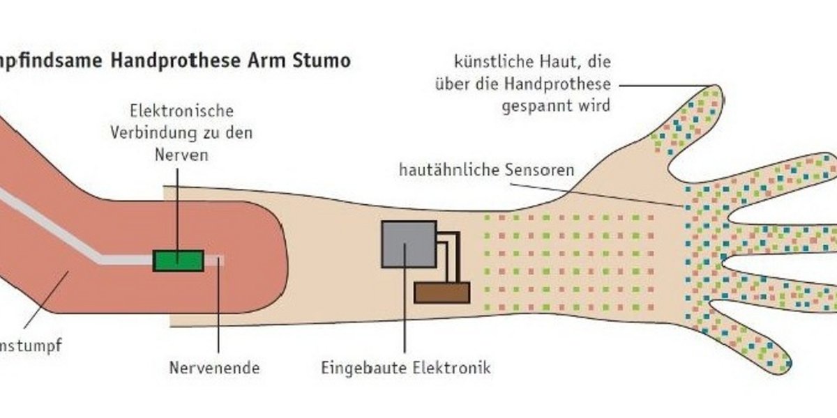 Die empfindsame Handprothese Arm Stumo  &#40;Bild: © EPFL&#41;