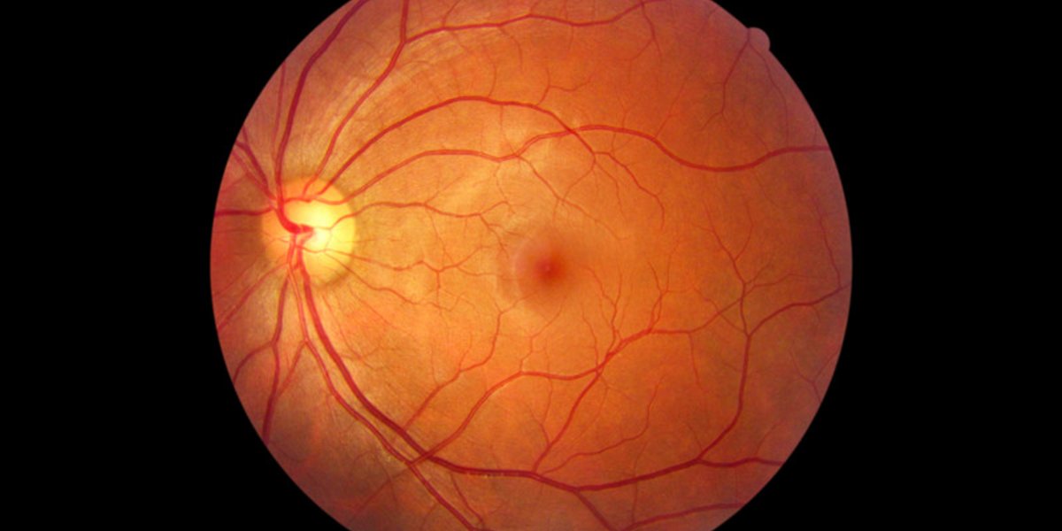 SimplyScience Gelber Fleck und blinder Fleck was ist der Unterschied?