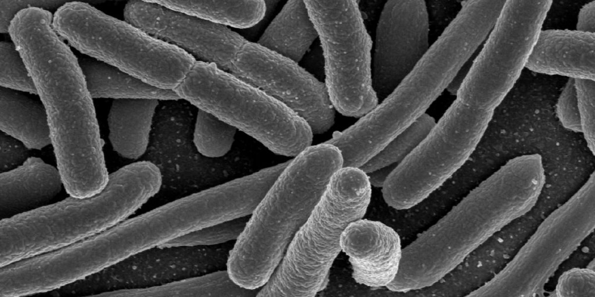 Unter dem Mikroskop sehen Escherichia-Bakterien aus wie kleine Stäbchen