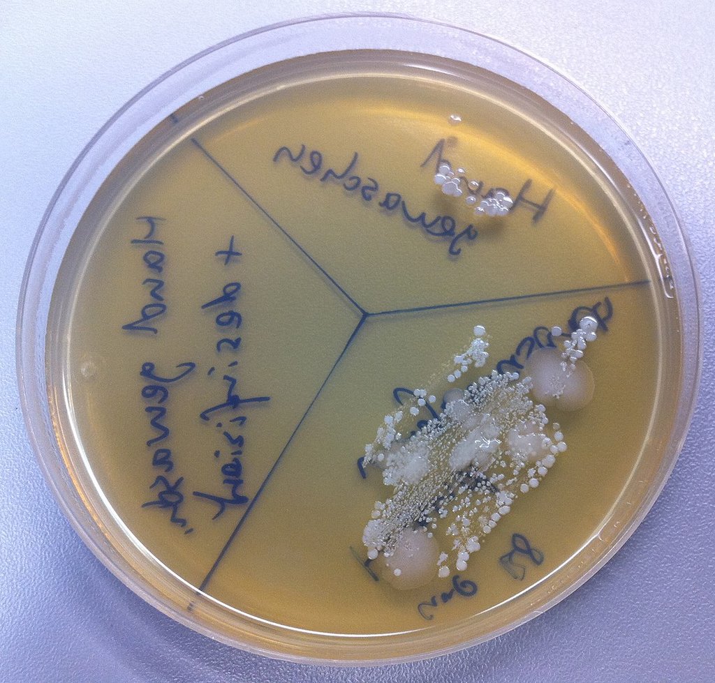 Agarplatte, geteilt in drei unterschiedlich von Bakterien bewachsene Bereiche