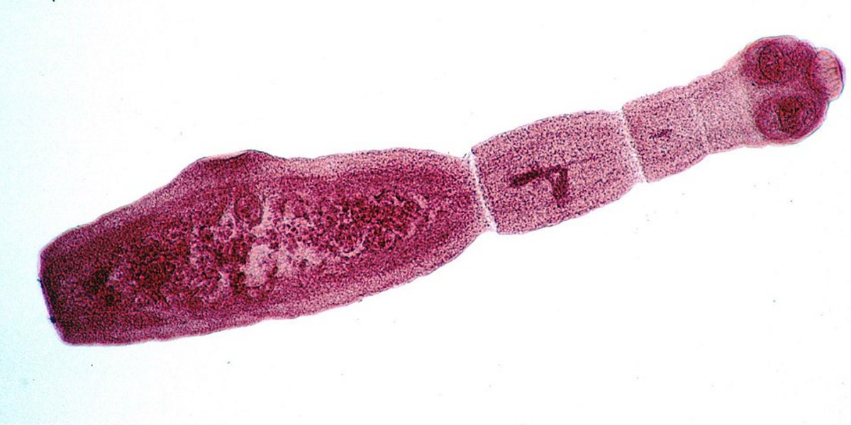 Gefärbter Fuchsbandwurm unter dem Mikroskop