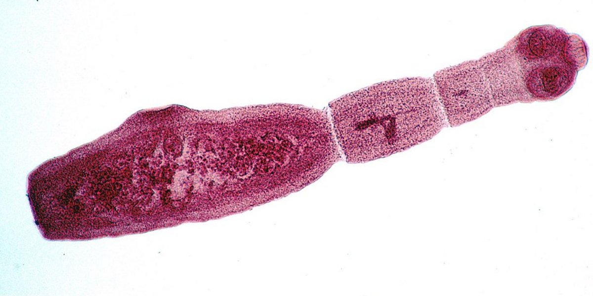 Ténia du renard vue au microscope &#40;échantillon coloré&#41;