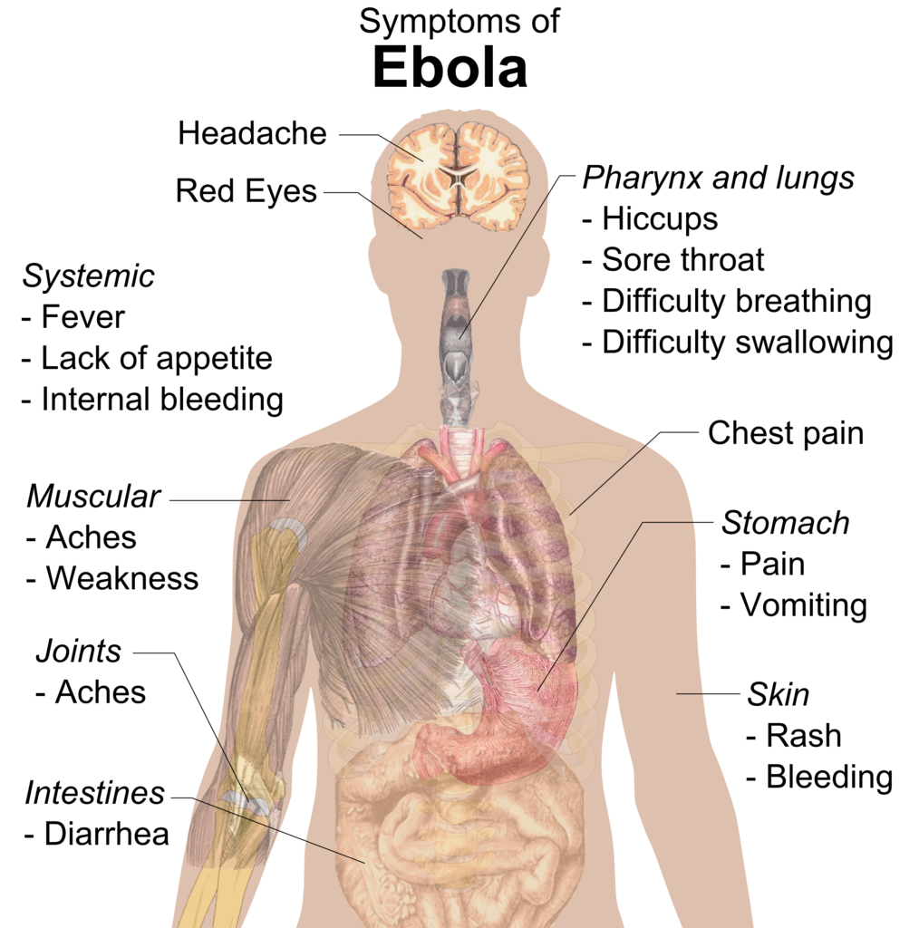 Schéma décrivant les symptômes d'Ebola