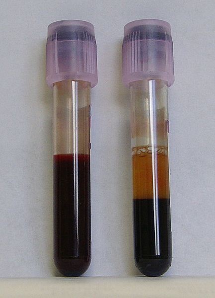 Echantillon de sang dans un tube