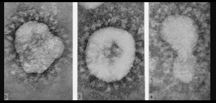 Coronavirus vus au microscope électronique