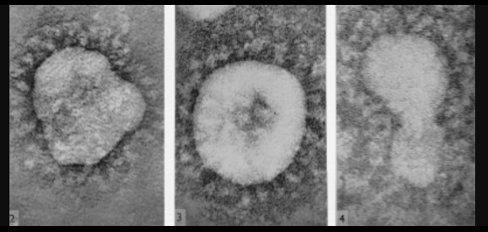 Coronaviren im Elektronenmikroskop