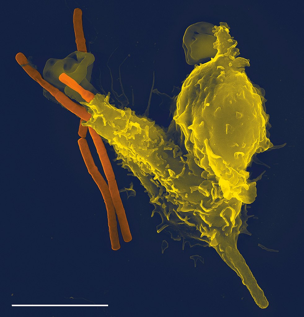 Weisse Blutzelle und Milzbrandbakterium im Elektronenmikroskop