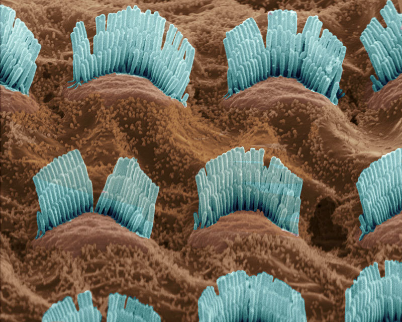 Cellules ciliées de l’oreille interne humaine