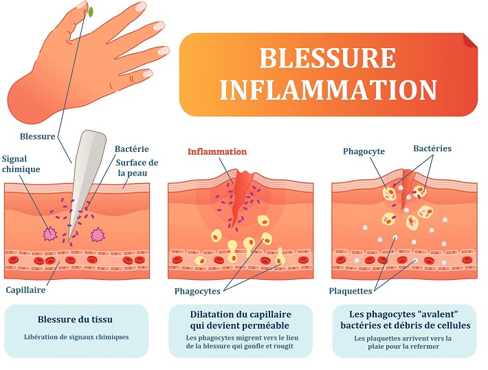 Réaction inflammatoire de défense