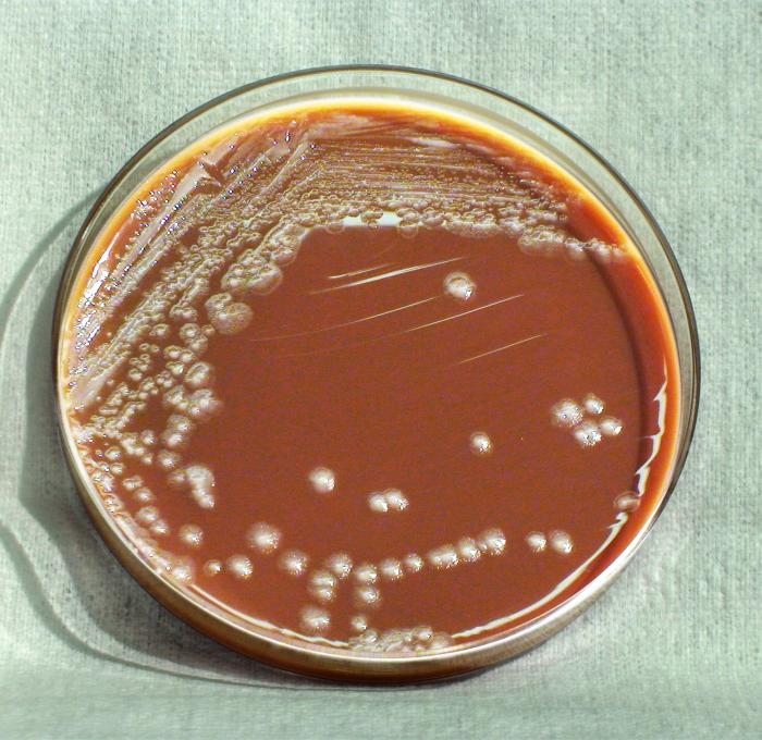 Culture de bacilles de la peste dans un milieu nutritif contenant des globules rouges