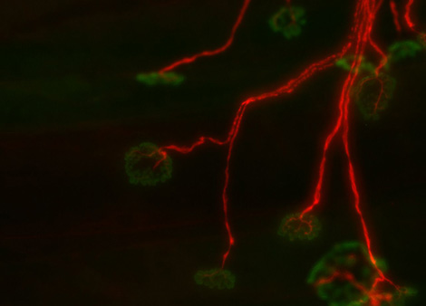 Jonction neuromusculaire